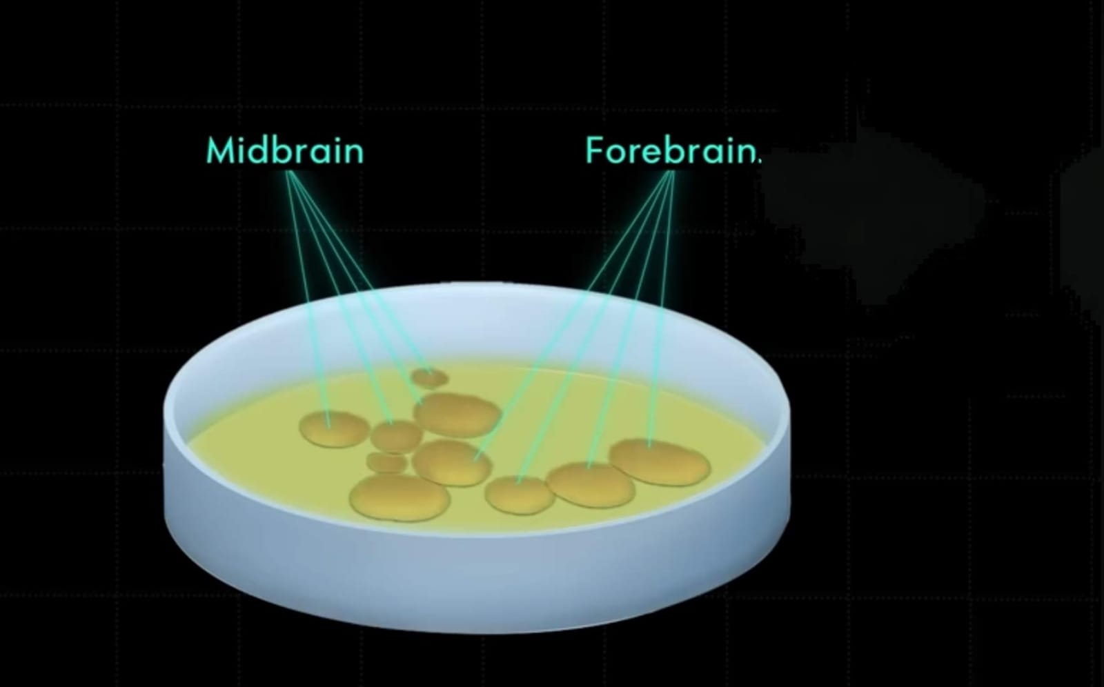 midbrain and forebrain